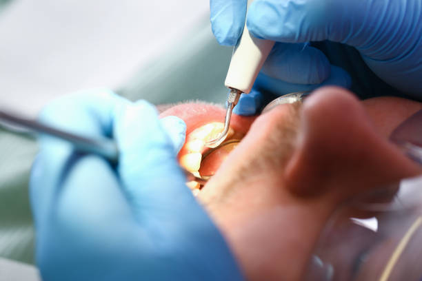 Best Dental Abscess Treatment in Port St Joe, FL